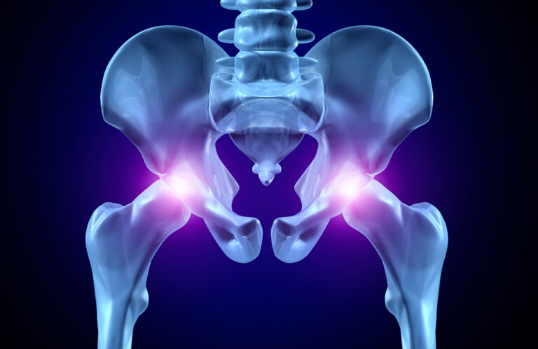 Anterior Total Kalça Protezi Ameliyatı